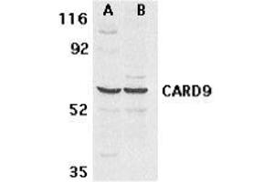 Western blot analysis of CARD9 expression in human MDA-MB-361 (A) and PC-3 (B) cell lysate with AP30185PU-N CARD9 antibody at 2. (CARD9 Antikörper)