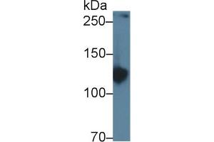 Western Blot; Sample: Rat Serum; Primary Ab: 1µg/ml Rabbit Anti-Rat AMPH Antibody Second Ab: 0. (Amphiphysin Antikörper  (AA 24-240))