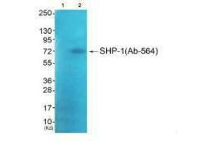 Western blot analysis of extracts from JK cells (Lane 2), using SHP-1 (Ab-564) antiobdy. (MSK1 Antikörper  (C-Term))