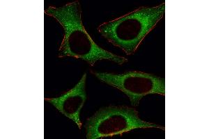 Fluorescent image of Hela cell stained with PI3KCD Antibody . (PIK3CD Antikörper  (C-Term))