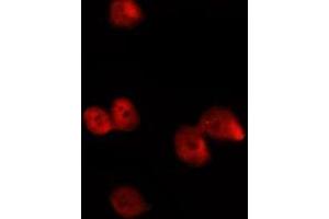 ABIN6277192 staining HepG2 by IF/ICC. (Histone 3 Antikörper  (H3K4me))