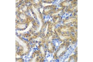 Immunohistochemistry of paraffin-embedded rat kidney using FAH antibody.