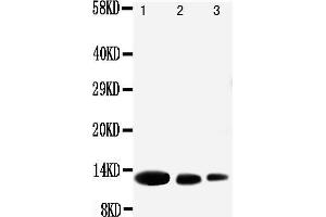 Anti-MIG antibody, Western blotting Lane 1: Recombinant Human CXCL9 Protein 10ng Lane 2: Recombinant Human CXCL9 Protein 5ng Lane 3: Recombinant Human CXCL9 Protein 2.