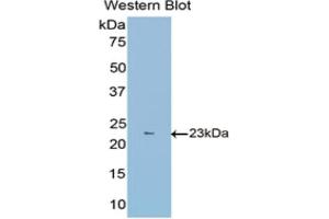 Detection of Recombinant FBLN1, Mouse using Polyclonal Antibody to Fibulin 1 (FBLN1) (Fibulin 1 Antikörper  (AA 399-578))