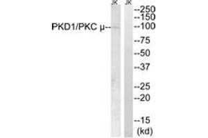Western blot analysis of extracts from Jurkat cells, using PKD1/PKC mu (Ab-910) Antibody. (PKC mu Antikörper  (AA 863-912))