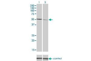 Western blot analysis of CAMK2D over-expressed 293 cell line, cotransfected with CAMK2D Validated Chimera RNAi (Lane 2) or non-transfected control (Lane 1).
