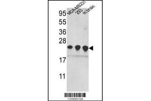 Western blot analysis of PRDX2 Antibody in MDA-MB231,293 cell line and mouse brain tissue lysates (35ug/lane)(2ug/ml) (Peroxiredoxin 2 Antikörper  (C-Term))
