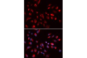 Immunofluorescence analysis of U2OS cells using CHRM5 antibody (ABIN5973103). (CHRM5 Antikörper)