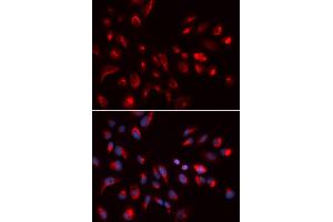 Immunofluorescence analysis of U2OS cells using CHRM5 antibody (ABIN5973103). (CHRM5 Antikörper)