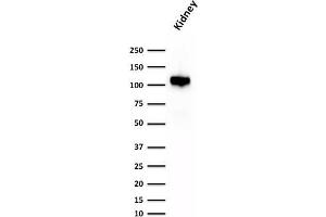 Western Blot Analysis of human Kidney lysate using KSP-Cadherin Rabbit Recombinant Monoclonal Antibody (CDH16/1532R) (Rekombinanter Cadherin-16 Antikörper)