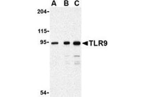 Western blot analysis of TLR9 in Jurkat cell lysate with this product at (A) 0.