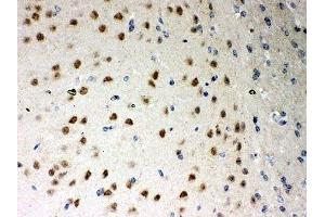 IHC-P: PKC iota antibody testing of mouse brain tissue (PKC iota Antikörper  (AA 21-214))