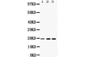 Western blot analysis of PC4 expression in rat liver extract ( Lane 1), HELA whole cell lysates ( Lane 2) and U2OS whole cell lysates ( Lane 3). (SUB1 Antikörper  (C-Term))