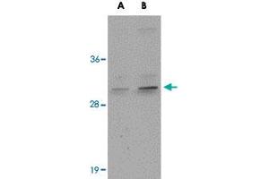 Western blot analysis of CENPO in mouse kidney tissue lysate with CENPO polyclonal antibody  at (A) 1 and (B) 2 ug/mL . (CENPO Antikörper  (Internal Region))
