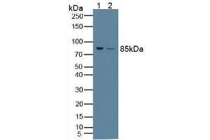 Figure. (PFKP Antikörper  (AA 247-473))