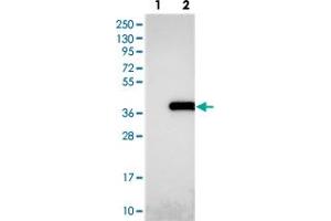 Western blot analysis of Lane 1: Negative control (vector only transfected HEK293T lysate), Lane 2: Over-expression Lysate (Co-expressed with a C-terminal myc-DDK tag (~3. (NUDT22 Antikörper)