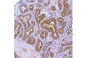 IHC analysis of Optineurin using anti-Optineurin antibody (ABIN3042498).