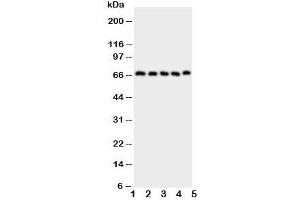 Western blot testing of COX2 antibody and Lane 1:  human placenta;  2: COLO320;  3: HeLa;  4: PANC;  5: SKOV cell lysate. (COX2 Antikörper  (AA 589-604))