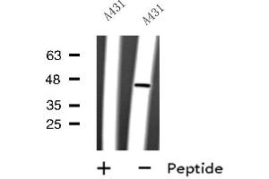 Western blot analysis of CYLC2 expression in A431 whole cell lysate ,The lane on the left is treated with the antigen-specific peptide. (CYLC2 Antikörper  (C-Term))