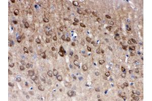 Anti- PGP9. (UCHL1 Antikörper  (C-Term))