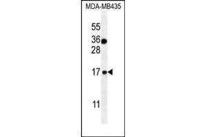 Western blot analysis in MDA-MB435 cell line lysates (35 ug/lane) using S100A1 Antibody (Center) Cat.