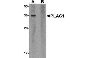 Western blot analysis of PLAC1 in human placenta tissue lysate with PLAC1 antibody at 1 μg/ml in (A) the absence and (B) the presence of blocking peptide. (PLAC1 Antikörper  (C-Term))