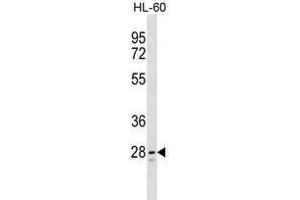 TLCD1 Antibody (C-term) western blot analysis in HL-60 cell line lysates (35 µg/lane). (TLCD1 Antikörper  (C-Term))