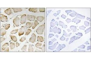 Immunohistochemistry analysis of paraffin-embedded human skeletal muscle tissue, using Arachidonate 5 Lipoxygenase (Ab-271) Antibody. (ALOX5 Antikörper  (AA 246-295))