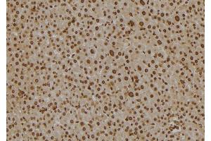 ABIN6277130 at 1/100 staining Mouse liver tissue by IHC-P. (SCCPDH Antikörper)
