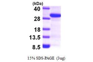 SDS-PAGE (SDS) image for SCAN Domain Containing 1 (SCAND1) (AA 1-179) protein (His tag) (ABIN667831) (SCAND1 Protein (AA 1-179) (His tag))
