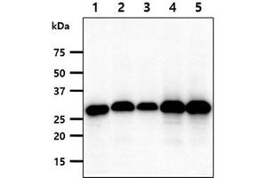 The cell lysates(40ug) were resolved by SDS-PAGE, transferred to PVDF membrane and probed with anti-human FHL2 antibody (1:1000).