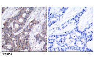 Image no. 1 for anti-Stathmin 1 (STMN1) (pSer15) antibody (ABIN196987) (Stathmin 1 Antikörper  (pSer15))