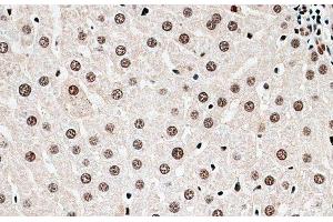 Immunohistochemistry of paraffin-embedded Rat liver using CBX6 Polyclonal Antibody at dilution of 1:100 (40x lens). (CBX6 Antikörper)