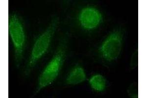 ODZ3 polyclonal antibody (Cat # PAB11565, 10 ug/mL) staining of nuclei HeLa cells (green).