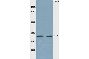 Rat lung lysates probed (ABIN679718) at 1:200 in 4 °C. (EPO Antikörper  (AA 101-193))