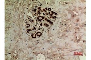 Immunohistochemical analysis of paraffin-embedded human-breast, antibody was diluted at 1:100.