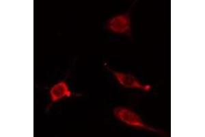 ABIN6275201 staining Hela cells by IF/ICC. (IQCB1 Antikörper  (Internal Region))