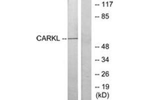 Western Blotting (WB) image for anti-Sedoheptulokinase (SHPK) (AA 31-80) antibody (ABIN2889797) (SHPK Antikörper  (AA 31-80))