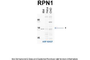 WB Suggested Anti-RPN1 Antibody Titration: 1 ug/mlPositive Control: HeLa and CHO-K1 cell lines, rouch canine microsomes