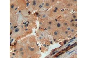 Used in DAB staining on fromalin fixed paraffin-embedded liver tissue (SAA2 Antikörper  (AA 20-122))