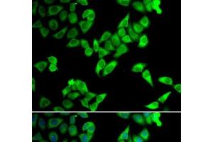 Immunofluorescence analysis of U2OS cells using TRIP10 Polyclonal Antibody (TRIP10 Antikörper)