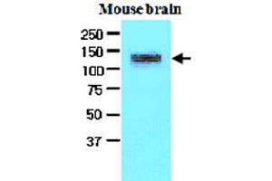 The extracts of mouse brain (50 ug) were resolved by SDS-PAGE, transferred to NC membrane and probed with EPHA2 monoclonal antibody, clone 3D7  (1:500). (EPH Receptor A2 Antikörper  (AA 559-976))