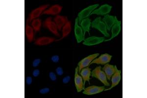 ABIN6258609 and ABIN6274191 staining Hela cells(30 min of UV treatment) by IF/ICC. (Hexokinase 1 Antikörper  (N-Term))