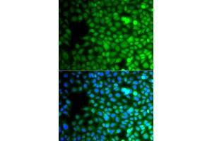 Immunofluorescence analysis of A549 cells using ZNF195 antibody (ABIN4905676).