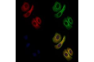 ABIN6261281 and ABIN6279354 staining Hela cells by IF/ICC. (DGAT2 Antikörper  (Internal Region))
