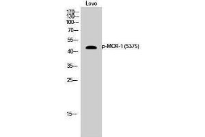 Western Blotting (WB) image for anti-Opioid Receptor, mu 1 (OPRM1) (pSer375) antibody (ABIN3173387) (Mu Opioid Receptor 1 Antikörper  (pSer375))