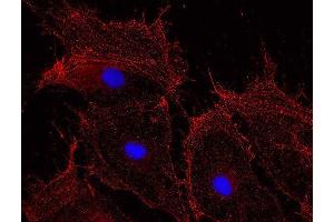 Indirect immunostaining of methanol fixed rat fibroblasts (dilution 1 : 500; red).