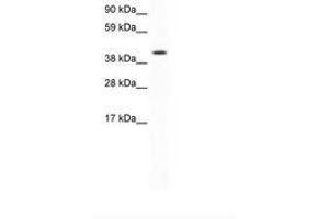 Image no. 1 for anti-Forkhead Box F1 (FOXF1) (AA 276-325) antibody (ABIN202323) (FOXF1 Antikörper  (AA 276-325))