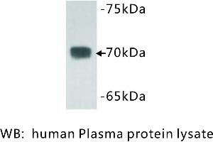 Image no. 1 for anti-Complement C3 beta Chain (C3b) antibody (ABIN1112803) (Complement C3b Antikörper)