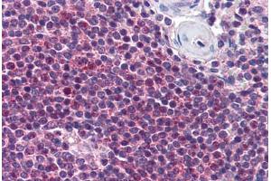 Human Spleen (formalin-fixed, paraffin-embedded) stained with NIACR2 antibody ABIN290337 at 10 ug/ml followed by biotinylated goat anti-rabbit IgG secondary antibody ABIN481713, alkaline phosphatase-streptavidin and chromogen. (GPR109B Antikörper  (AA 1-50))